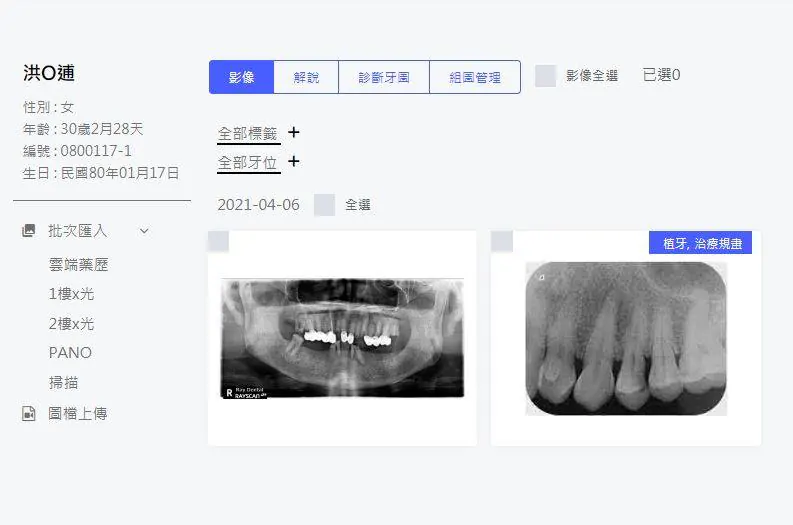口腔影像管理畫面