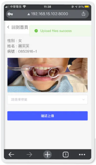 手機上傳口腔照片畫面